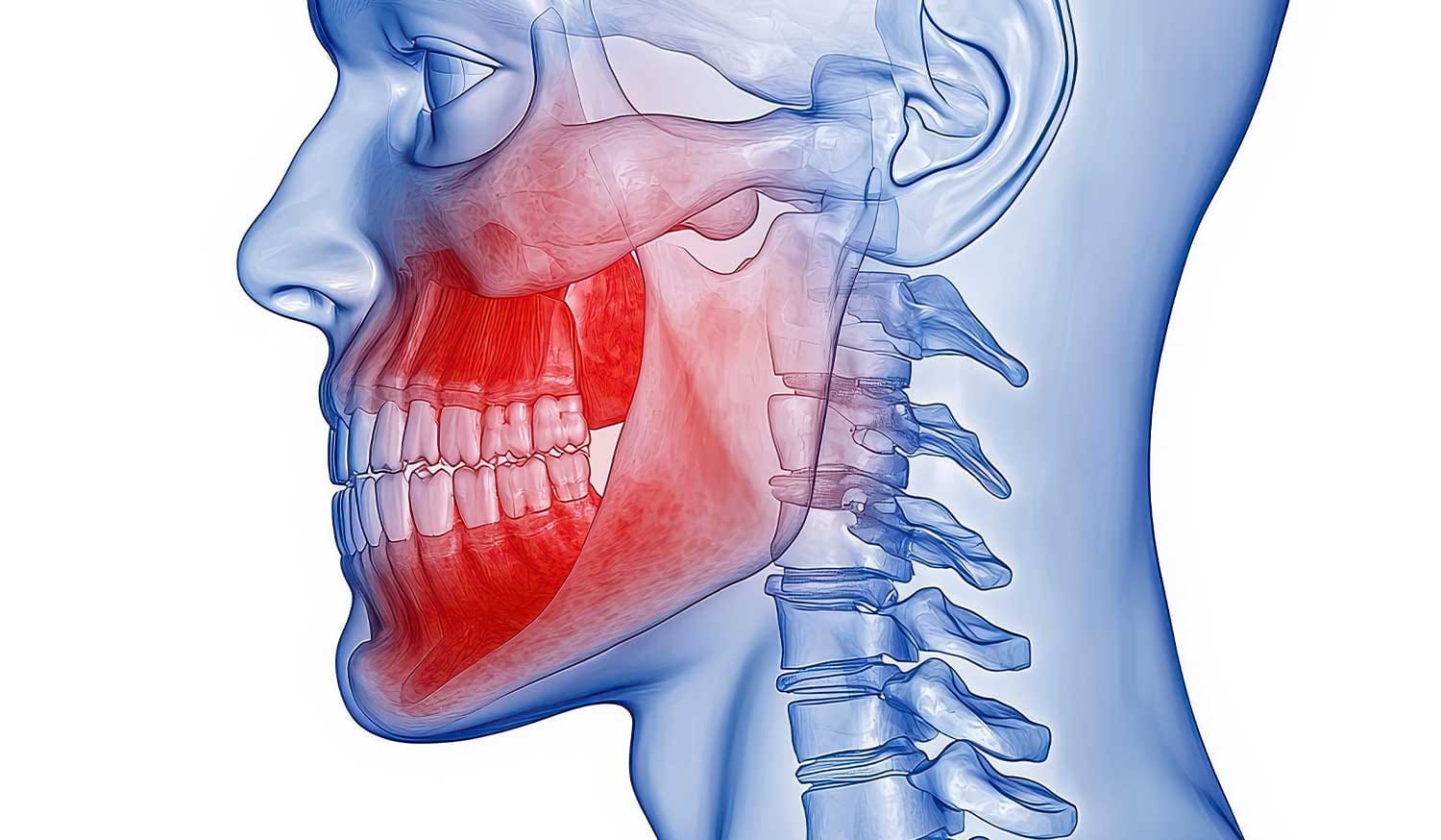 TMJ or toothache