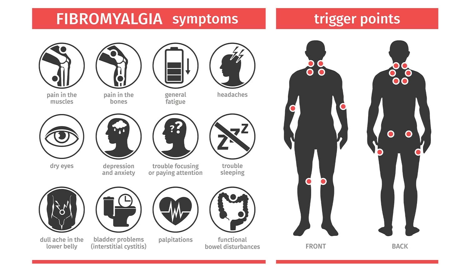 IASTM for fibromyalgia treatment