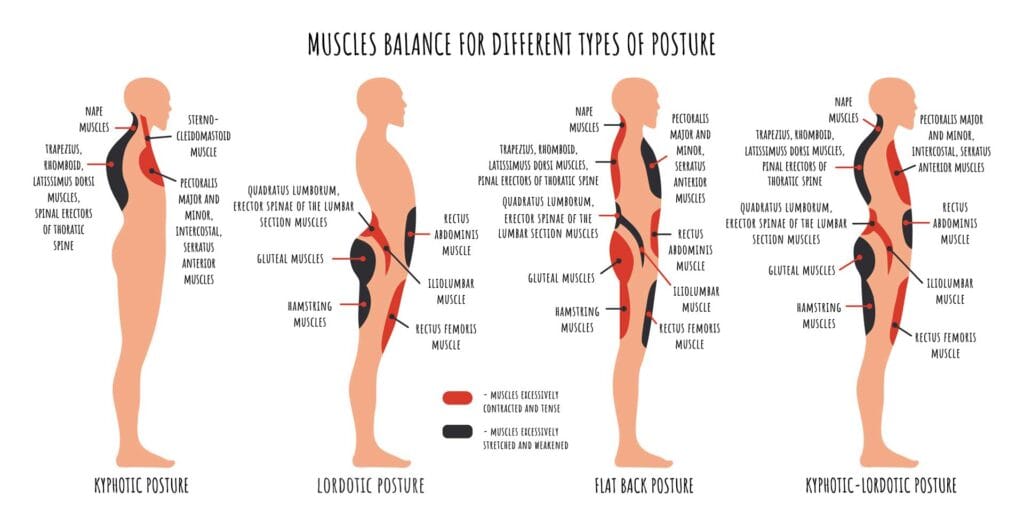 Benefits of Correcting Postural Imbalance with Osteopathy | MHV Clinic