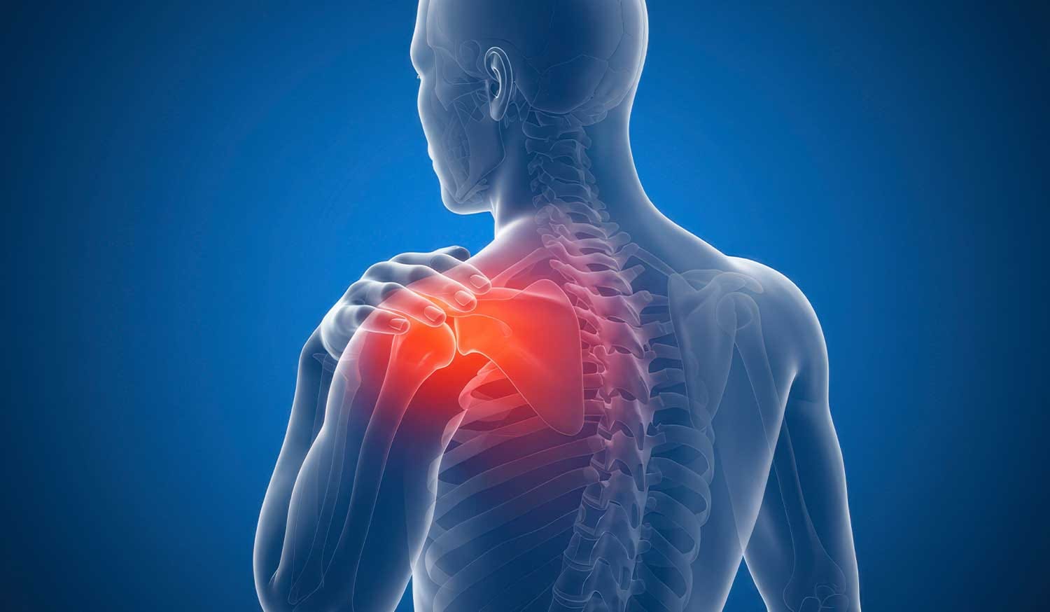 causes of frozen shoulder