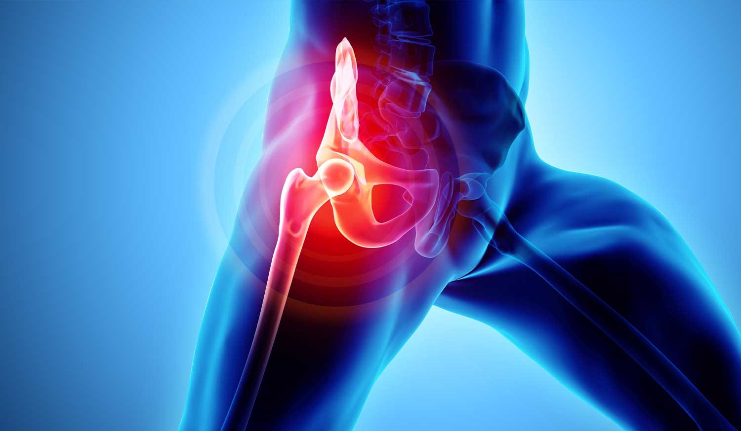 osteopathy for hip pain