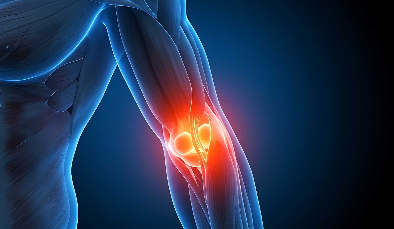 Tendinitis Treatment Recovery Time Tips