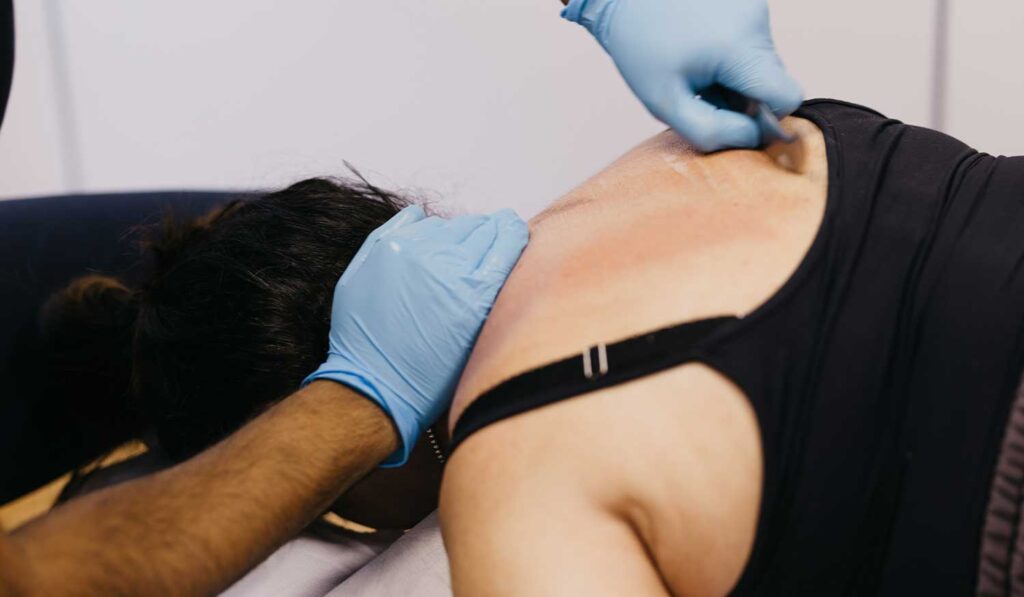 When to Choose Osteopathy for Generalised Muscle Pains